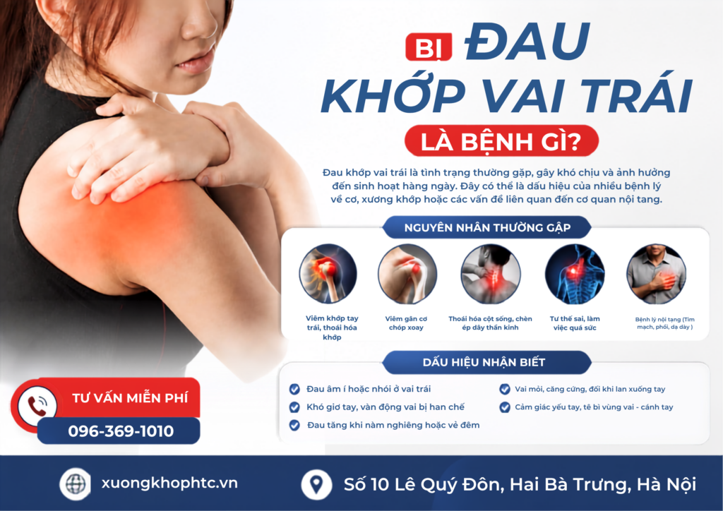 Bị Đau Khớp Vai Trái Là Bệnh Gì?