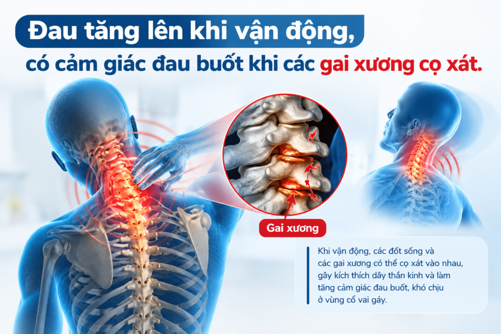 Đau tăng lên khi vận động, có cảm giác đau buốt khi các gai xương cọ xát