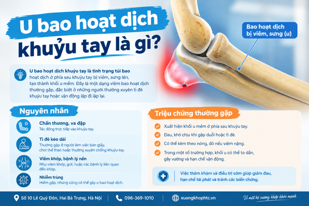 U bao hoạt dịch khuỷu tay là gì?