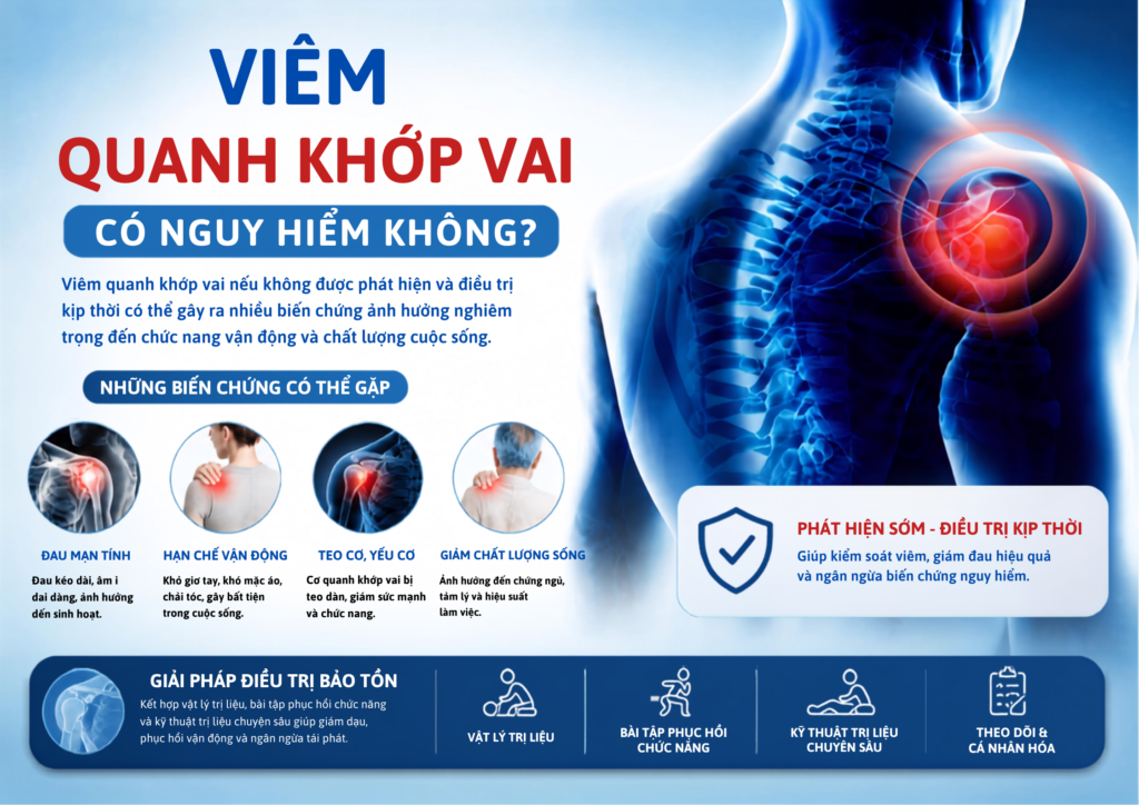 Viêm quanh khớp vai có nguy hiểm không?
