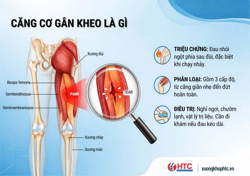 Căng Cơ Gân Kheo Là Gì? Nguyên Nhân, Triệu Chứng Và Phục Hồi