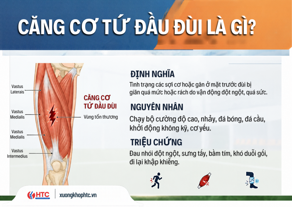 Căng cơ tứ đùi là gì? Nguyên nhân, triệu chứng và cách xử trí