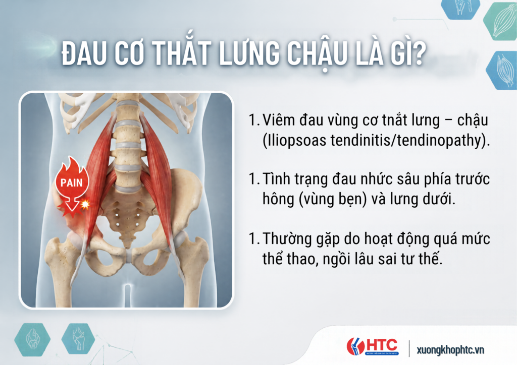 Đau Cơ Thắt Lưng Chậu Là Gì? Nguyên Nhân, Triệu Chứng Và Cách Khắc Phục