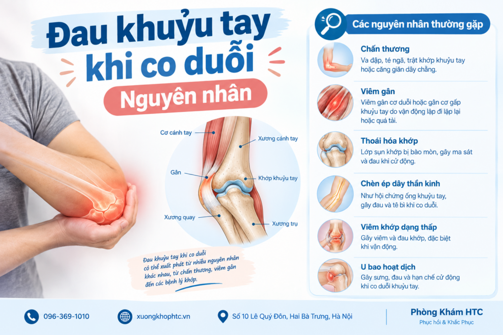 Đau khuỷu tay khi co duỗi: Nguyên nhân thường gặp