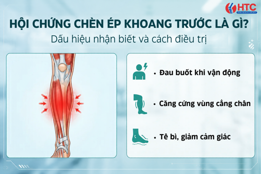 Hội chứng chèn ép khoang trước là gì? Nguyên nhân, dấu hiệu và hướng điều trị