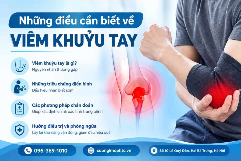 Những Điều Cần Biết Về Viêm Khuỷu Tay: Nguyên Nhân, Triệu Chứng Và Cách Điều Trị