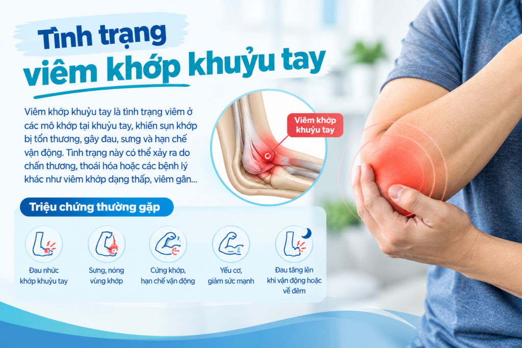 Tình trạng viêm khớp khuỷu tay – Nguyên nhân, dấu hiệu và cách nhận biết
