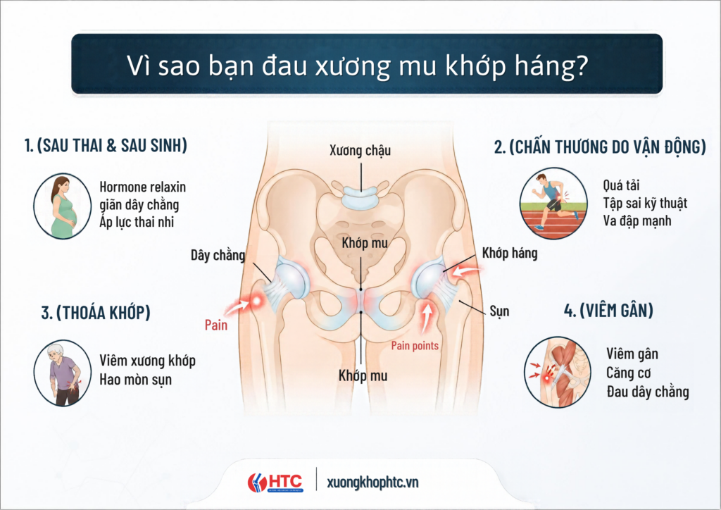 Vì sao bạn đau xương mu khớp háng?