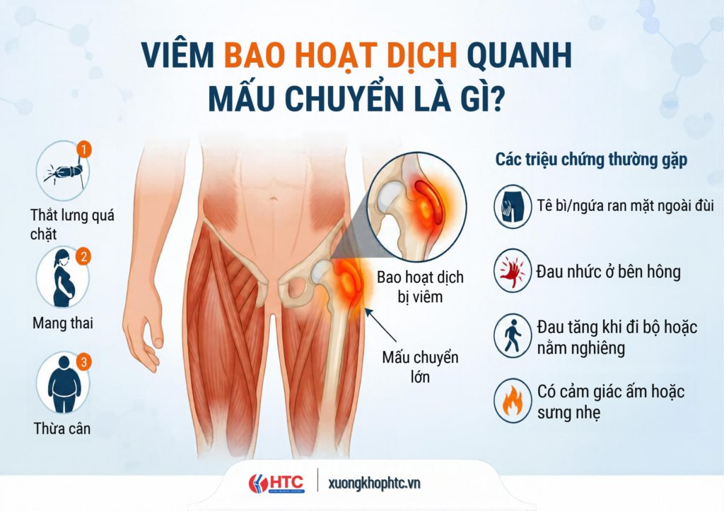 Viêm Bao Hoạt Dịch Quanh Mấu Chuyển Là Gì? Nguyên Nhân, Triệu Chứng Và Điều Trị