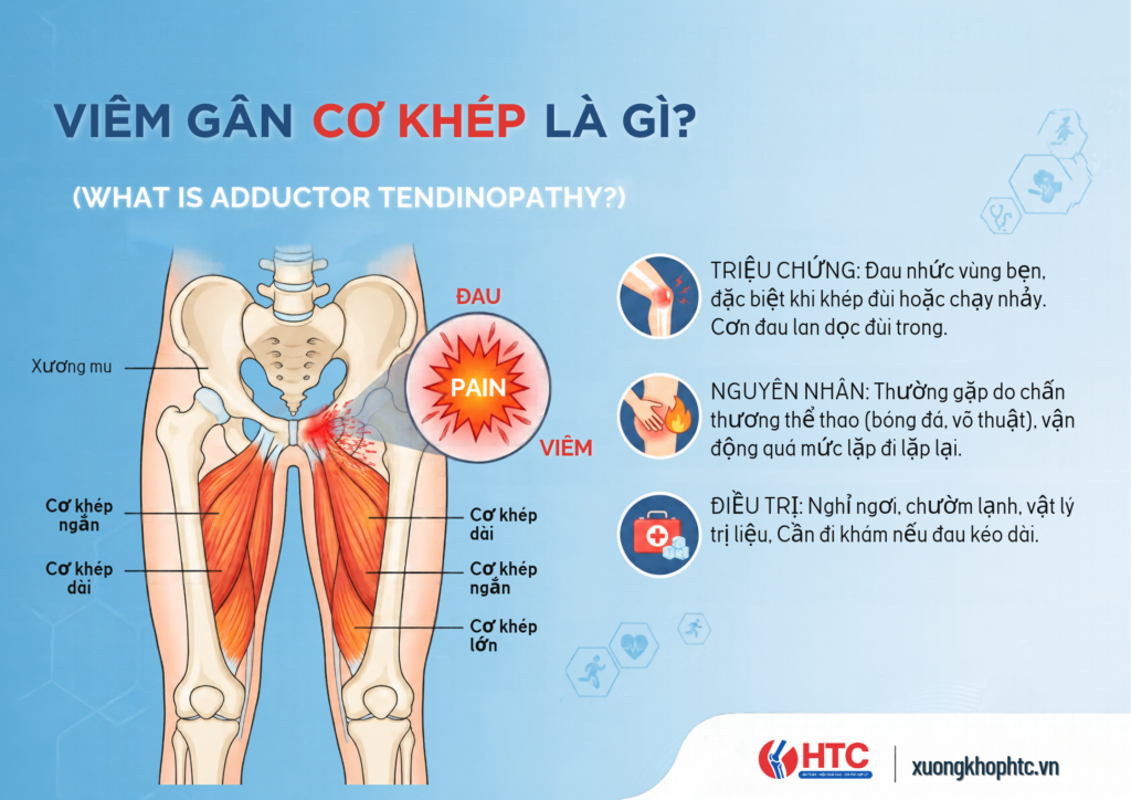 Viêm Gân Cơ Khép Là Gì? Nguyên Nhân, Dấu Hiệu Và Cách Điều Trị