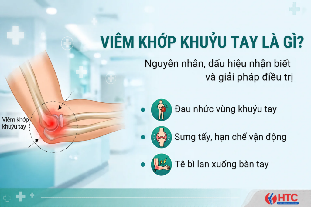 Viêm khớp khuỷu tay là gì? Nguyên nhân, triệu chứng và cách cải thiện